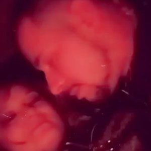 Meet your Posher, Phillip